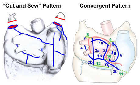 'Cut and Sew' Pattern and Convergent Pattern